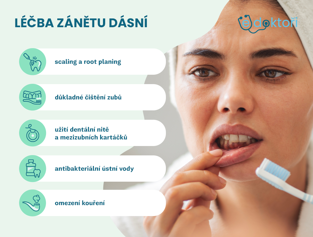 léčba zánětu dásní