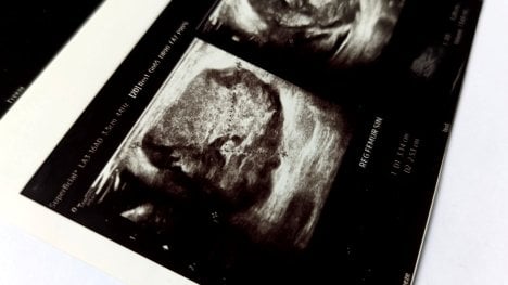 Screening zhoubných nádorů