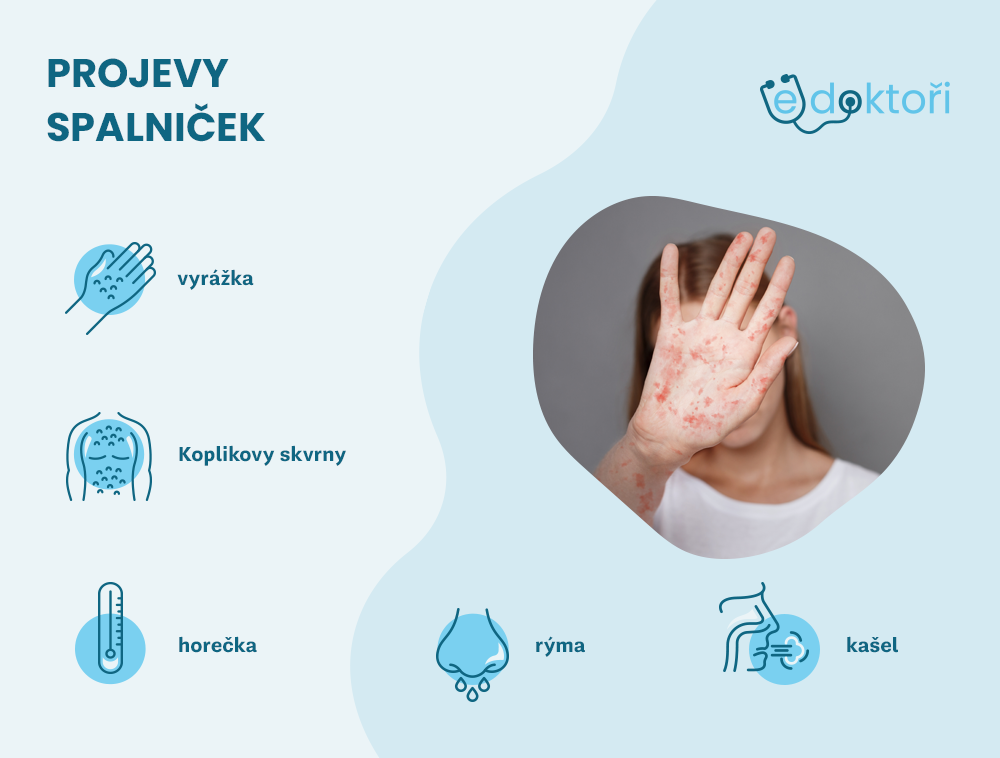 spalničky příznaky