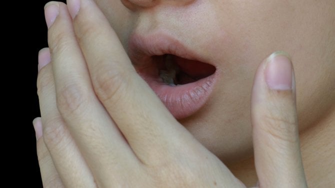 Zápach z úst diskuze