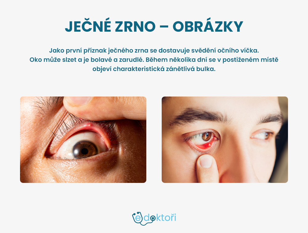 Ječné zrno foto