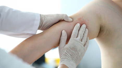 Bolest kůže na dotek